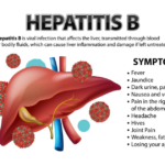 হেপাটাইটিস বি এর লক্ষণ ও প্রতিকার
